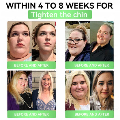 🔥Alcuras™ Moringa × Berberine × AMPK 8-Benefit Slimming & Metabolic Nano Microneedle Patch 🇺🇸  Just once a day · Visible changes in 7 days  ✅ For obesity, loose skin, diabetes, sleep apnea, joint issues, and more
