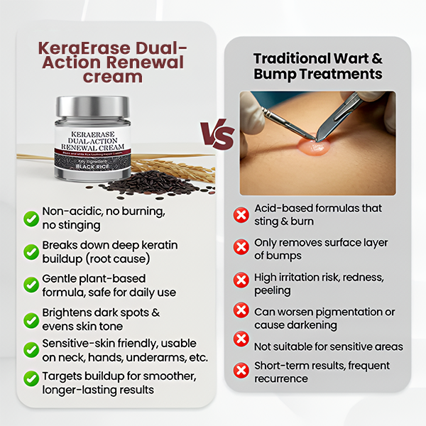 ✅Flash Sale -HEALRIZE®  KeraErase Dual-Action Renewal Cream
